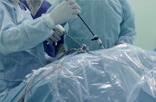 Laparoscopic view of a normal female pelvis